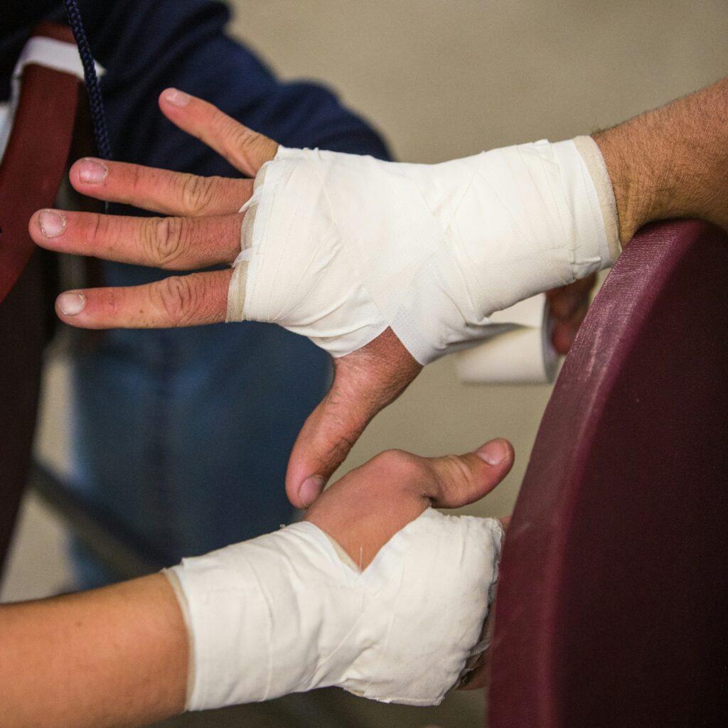 hand injuries