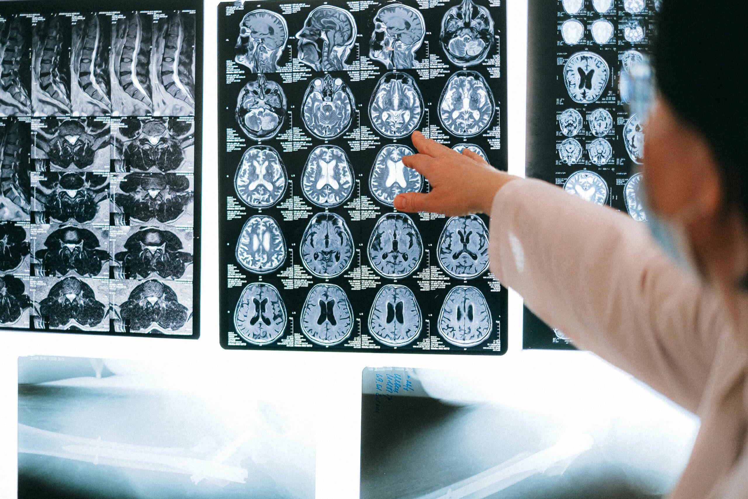 brain scans